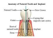 Instruments of the dental care at your doorsteps