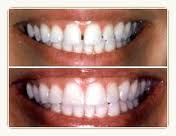 Dental Surgery offer you a beautiful smile 