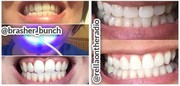 ONLY Way To Whiten Your Teeth- https://cutt.ly/uVIxlU2